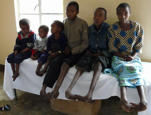 Tansanischer Kinder mit Brandverletzungen oder Bein- und Fußfehlstellungen im Nkoaranga Hospital