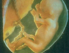 Embryo, 12 Wochen