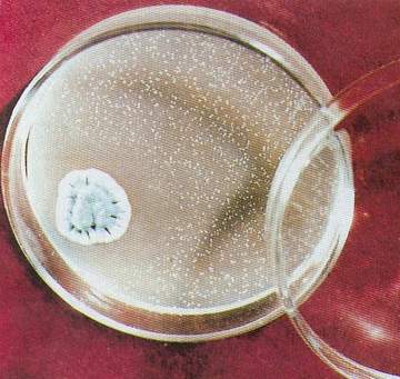 Laborversuch : Bakterienabtötung durch Bakterien in Petrischale